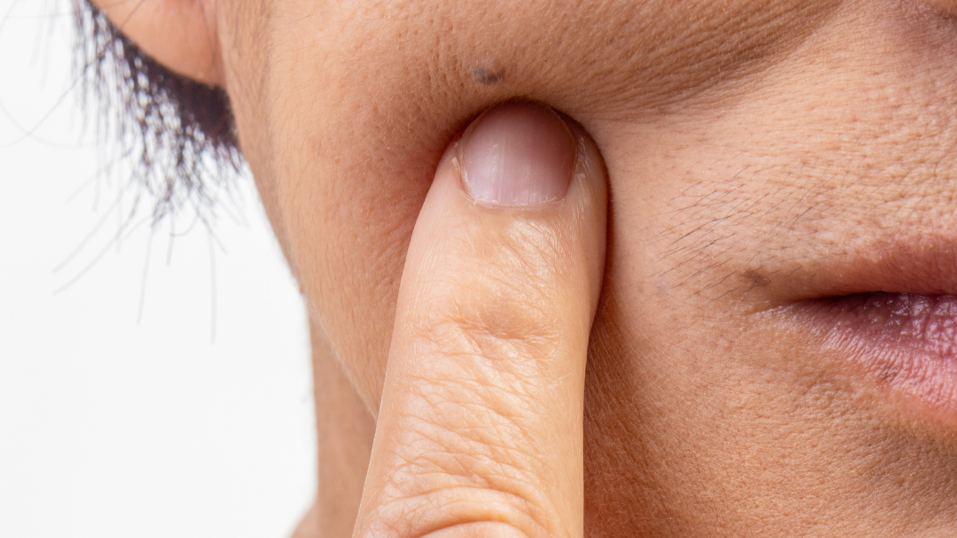 Droge huid overgang I FemmePrex
